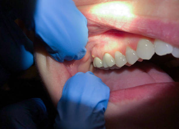 Best Emergency Gum Pain Relief  in Kenmar, PA