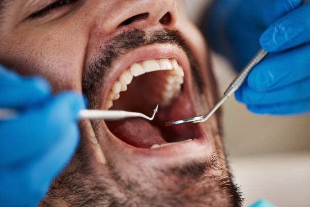 Best Cracked Tooth Emergency Dentist  in Kenmar, PA