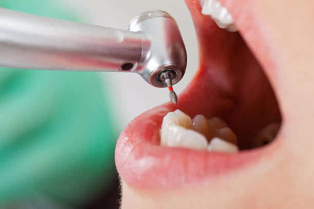 Best Chipped Tooth Repair Near Me  in Kenmar, PA